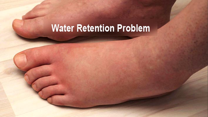 What Causes Water Retention Problems